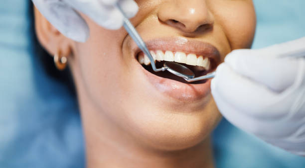 Best Emergency Tooth Extraction in Paonia, CO